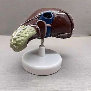 Modèle de Pathologie du Cancer du Foie avec Base - Spécimen Pédagogique d'Hépatologie - Product Image 3