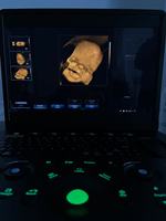 Taşınabilir Ultrason Probu Veteriner Renkli Doppler 3D 4D Ultrason Cihazı
