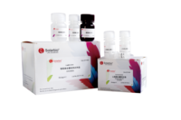 Sol Acide Phosphatase (S-ACP) Activité Kit de Dosage