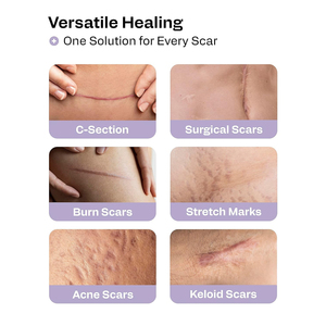 Cinta de Silicona para Cicatrices de Doble Hidratación Personalizable con Gel, Marca Privada - Product Image 5