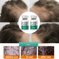 Thérapie de repousse des cheveux anti-chute de cheveux avancée 10 milliards d'exosomes cellules souches EGF Poudre lyophilisée Solution Elixir de croissance des cheveux Accélérateur