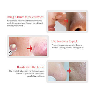 หน้ากากสีดำแบบลอกออกได้สำหรับใบหน้าหน้ากากปิดจมูกจมูกกำจัดน้ำมันหัวสีดำ - Product Image 4