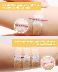 Dispositif de Fermeture de Plaies à Fermeture Éclair Sans Douleur pour Urgences, Vente en Gros Usine, Pansement à Fermeture Éclair Désinfectant pour Fermetures de Plaies - Product Image 4