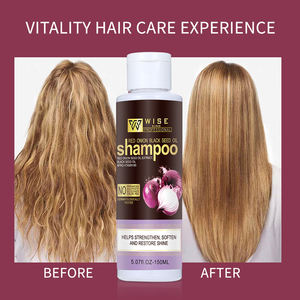 Shampooing Wiseking Oignon Rouge pour la Croissance Capillaire 150 ML, Soin Contrôle Sébum à l'Huile de Nigelle, Vitamine B5 pour <span class=keywords><strong>Cheveux</strong></span> Abîmés - Product Image 5