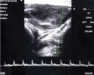 Mesin <span class=keywords><strong>Ultrasound</strong></span>, pendeteksi Doppler warna medis portabel saku tanpa kabel Wi-Fi pemindai <span class=keywords><strong>ultrasound</strong></span> - Product Image 6