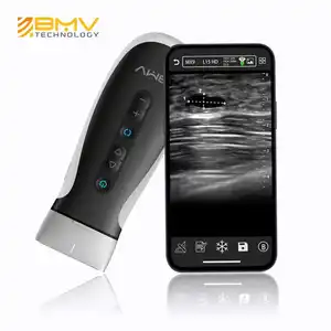 Pocket Color Ultrasound Scanner Android IOS Windows Portable Wifi Wireless Ultrasound With Changeable Ultrasound Heads