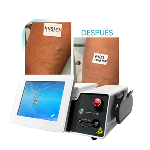 Láser Médico <span class=keywords><strong>de</strong></span> 980nm y 1470nm <span class=keywords><strong>para</strong></span> EVLA (Eliminación Endovenosa <span class=keywords><strong>de</strong></span> Venas Varicosas), Eliminación <span class=keywords><strong>de</strong></span> Venas Varicosas en <span class=keywords><strong>las</strong></span> <span class=keywords><strong>Piernas</strong></span>, Ablación Láser - Product Image 1