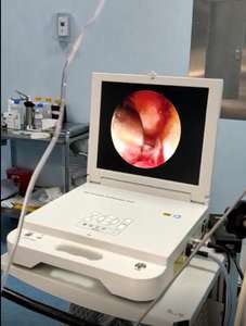 Caméra endoscopique médicale portable Full HD 17 pouces pour ordinateur portable, tout-en-un - Product Image 6