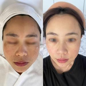 เซรั่มบำรุงผิวหน้าให้เปล่งประกายและกระจ่างใส ช่วยขจัดสารโลหะหนักบนใบหน้า ลดเลือนจุด<span class=keywords><strong>ด่าง</strong></span><span class=keywords><strong>ดำ</strong></span> ปรับสีผิวให้สม่ำเสมอ - Product Image 5