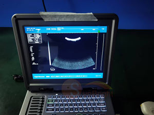 SUN-806A mesin <span class=keywords><strong>Ultrasound</strong></span> hitam dan putih portabel sistem diagnostik Digital penuh dengan pemindai untuk dokter hewan - Product Image 6