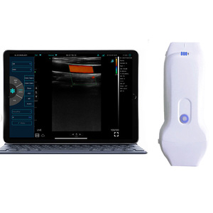 Портативный Ультразвуковой Сканер 3,5/5,0 МГц - Product Image 1