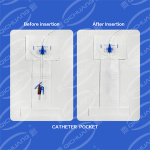 แผ่นปิดแผลแบบมีกาวในตัว ป้องกันสายสวนไตได้ผลดี ผลิตจากผ้าไม่ถักทอ สำหรับใส่สายสวนไต - Product Image 5