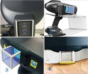 Peralatan terapi fisik medis semenanjung, lampu fototerapi Uvb sistem Laser Excimer 308nm untuk seri perawatan Vitiligo - Product Image 5