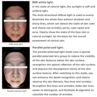 NewFace Professionnel 3D Imagerie De La Peau Humidité Huile Détection De Taches UV APP Intégration AI Machine D'analyze De La Peau pour Les Distributeurs