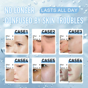 <b>Top</b> Sell 14+1 Oxygen Jet Diamond Microdermabrasion Skin Deep Cleaning Skin Rejuvenation Super <b>Bubble</b> Hydroo Aqua Facial Machine - Product Image 6