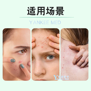 แผ่นแปะสิวไฮโดรคอลลอยด์ยูนนานไป๋เหยา 45 ชิ้น แผ่นบางใสสำหรับดูแลผิวหน้า - Product Image 4