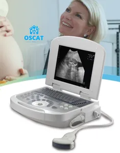 OSCAT pemindai Ultrasound, pegangan portabel dokter hewan hitam profesional untuk tes kehamilan