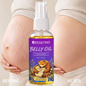 Aceite Corporal de Marca Privada para Aumentar la Elasticidad de la Piel, Suavizar la Piel Seca y Áspera, Aceite Nutritivo Orgánico para el Vientre de Embarazadas - Product Image 1
