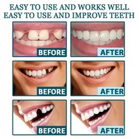 Juego de Dientes Ajustables para Dentadura Postiza, Carillas Estéticas, Blanqueamiento Dental, Dentadura Postiza Natural Portátil, Decoración para Espacios entre Dientes