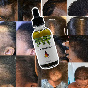 Pakistan indische Öle Name Massage für Männer Kerala vegan chinesische Bio-Kokosnuss Zöpfe mit Biotin natürlichen Haarwuchs öl - Product Image 4