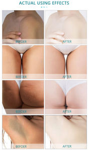 I migliori prodotti per la cura della pelle creme sbiancanti per il corpo ascella <span class=keywords><strong>tra</strong></span> <span class=keywords><strong>le</strong></span> <span class=keywords><strong>gambe</strong></span> la migliore crema sbiancante per la pelle del giorno della notte biologica - Product Image 5