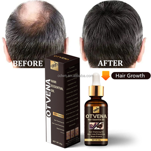 OTVENA Bouteilles d'huile capillaire à la biotine de marque privée Huiles capillaires pour la croissance des cheveux - Product Image 1