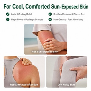 Gel Reparador Post-Solar de Marca Privada, Venta al por Mayor Directa de Fábrica OEM ODM, Gel Refrescante de <span class=keywords><strong>Aloe</strong></span> Vera para Alivio de Quemaduras Solares y Cuidado de la Piel - Product Image 3