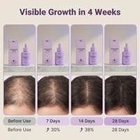 Serum Penumbuh Rambut Squalane Private Label 2 in 1 Perawatan Kulit Kepala Bernutrisi 60ml Unisex Tanpa Prostaglandin Bersertifikat GMPC Grosir