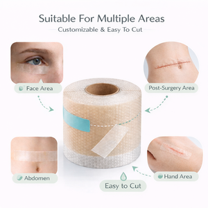 Láminas de Silicona para Cicatrices, Cinta de Silicona Reutilizable para Cicatrices de Cesárea, Queloides, Protuberancias, Estrías, Quemaduras, Eliminación de Cicatrices Quirúrgicas - Product Image 2
