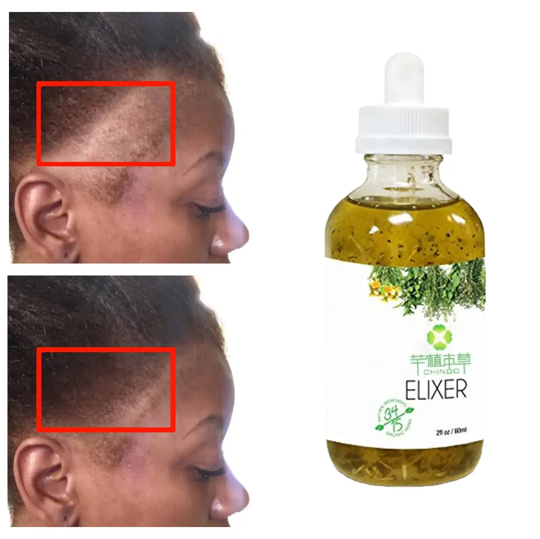 Özel etiket 100% doğal formülü toptan besleyici derisi Elixirs bakımı kaybı tedavisi saç büyüme yağı Serum