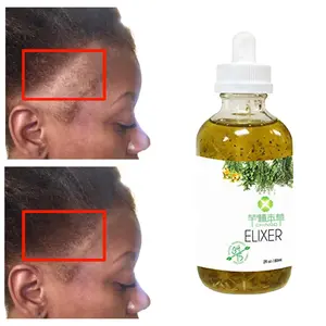 Label privé 100% naturel à base de plantes bio gros cuir chevelu élixirs soin perte traitement romarin croissance des cheveux huile sérum pour cheveux