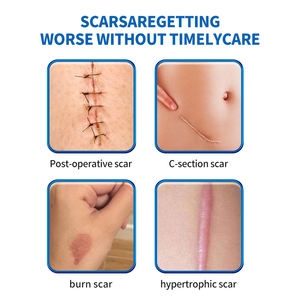 Lámina de Silicona Médica para Cicatrices, Apósito de Gel de Silicona Reutilizable para el Cuidado de Cicatrices de Acné y Quirúrgicas - Product Image 5