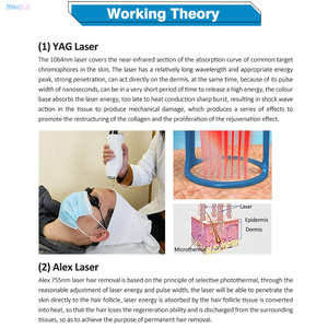 Máquina de depilación vertical <span class=keywords><strong>Alex</strong></span> Andrite y eliminación de tatuajes - Product Image 3