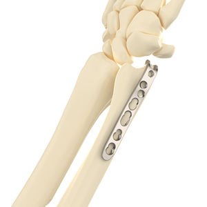 CANWELL pelat pengunci kait Ulna <span class=keywords><strong>Titanium</strong></span> <span class=keywords><strong>LCP</strong></span> disesuikan Mini kompresi tulang ortopedi implan luka patah CE OEM - Product Image 1