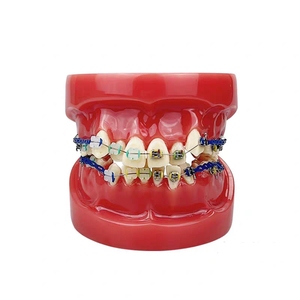 Vente en gros et au détail d'ensembles complets en acrylique modèle de dents dentaires étui orthodontique - Product Image 2