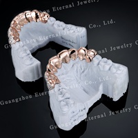 Grillz dentaire Hip-Hop personnalisé en or rose massif 14K, 2 à 10 diamants de laboratoire Moissanite taille brillant nid d'abeille, certifié unisexe