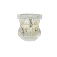Modelo Dental de Puente de Restauración Dental con Dientes Removibles Estándar, Modelo de Resina para Implantes, Modelo de Tipodonto para Enfermedades Dentales, para Estudio de Ciencias Médicas y Odontología