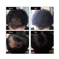 Serat Penambah Volume Rambut Herbal OEM, Penyamar Akar 2-in-1 dengan Bahan Alami, Bubuk Penambah Volume Instan
