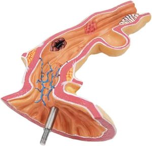 Modelo Patológico de Enfermedad Esofágica Humana para Ciencias Médicas, Modelo de Estómago para Enseñanza del Departamento de Gastroenterología del Hospital, Yulin CE/ISO - Product Image 2