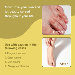 Zourunan Relieve Itchy <strong>Cream</strong> 20g External Skin Comfort Yellow Tube Wholesale Sourcing - Product Image 4