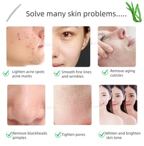 Alta calidad Natural Peeling Alge grado cosmético hidrolizado esponja Songilla polvo para Peeling a base de hierbas - Product Image 6