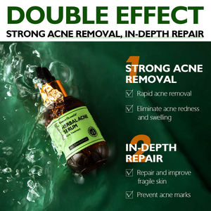 VIBRANT GLAMOUR sérum contre l'acné à base de plantes 17ml extrait de plantes contre l'acné élimine en douceur les cellules mortes de la peau et débouche les pores obstrués K1 - Product Image 4