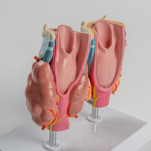 Modèle de thyroïde pathologique humaine SCIEDU Hyperthyroïdie et hypothyroïdie Système endocrinien Anatomie humaine Modèle de larynx thyroïdien - Product Image 5