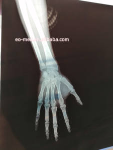 Beaucoup de conception intelligente d'imprimante à jet d'encre de film radiographique d'innovation avec l'encre noire double de type indépendant de 5 couleurs XP02 - Product Image 5