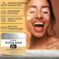 Crème de Traitement pour le Vitiligo – Crème de Pigmentation Contre les Dommages Solaires, Réduit les Taches et Unifie le Teint, Réparation Profonde