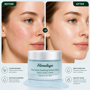 Crème Sorbet Apaisante à la Tanaisie Bleue Marque Blanche – Soulagement des Rougeurs, <span class=keywords><strong>Anti</strong></span>-<span class=keywords><strong>inflammatoire</strong></span>, Apaisant Après-Soleil - Product Image 6