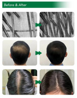 Sérum Capillaire Anti-Chute à Base de Peptides et Cellules Souches, Extrait Végétal, Facteur de Croissance EGF, Kit de Soin du Cuir Chevelu pour la Repousse des Cheveux et la Réparation des Follicules – Usage Professionnel en Salon