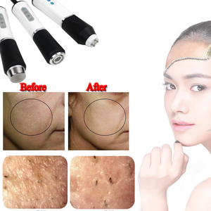 3 in 1 Facial Co2 Skin Rejuvenation Facial Machine for Home Use - Product Image 4