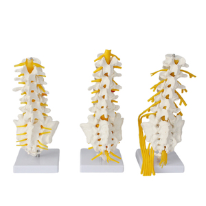 Modelo Lumbar 5 piezas 6 vértebras hueso FRT036 raíz nerviosa y lado derecho nervio sacro rama ciática herramienta <span class=keywords><strong>de</strong></span> enseñanza - Product Image 1
