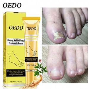 Crème à base de plantes Anti-fongique Pommade Onychomycose Paronychia Infection Traitement des champignons des ongles - Product Image 3